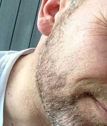 blow2gold Vorschaubild